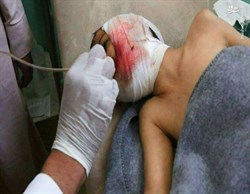 قطع اعضای بدن کودکان توسط سعودی ها